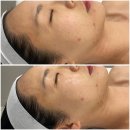 경기도 수원시 팔달구 중부대로106번길 29 (인계동) | 인계동 피부관리 [더라르떼 수원인계점] 1:1맞춤케어로 수원문제성피부 관리 후기