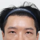 뷰리프성형외과의원