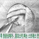 오산 화성 고양이 최소절개 무혈 무봉합 넥카라 필요없는 암컷 중성화 항문낭수술 앙꼬 후기