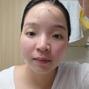 보니따뷰티(bonita beauty) | 라보니따 트라넥앰플 미백 기미 앰플 사용 후기