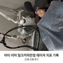 아이레이저랩 | 아이 이마 밀크커피반점 레이저 치료 기록 (20회 진행 후기)