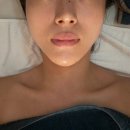 피오니에스테틱 | 해운대 피부관리 더함에스테틱 르함 에버피오니 리커버리케어 후기