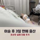 초산모 실제 출산 임박 증상 후기｜이슬부터 진진통 주기까지