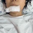 의료법인 음성소망의료재단 | 사진으로 보는 갑상선암 수술 후 회복과정😭솔직후기