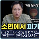 소변에서 피가 나와요! 암을 암시하는 혈뇨는? 이미지