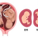 임신 때 태아가 거꾸로 있는 &#39;역아&#39;현상.. 해결기도문.. 이미지