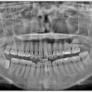 자연치과기공소 이미지