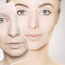 상떼(Sante') 이미지