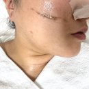 세븐일레븐 구미형곡스타점 | 구미 스킨플래닝 더마드스튜디오 후기 블랙헤드, 피지, 각질까지 깔끔 정리