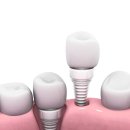 동래센트럴치과의원 이미지