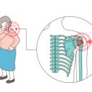 우신향정형외과의원 네이버블로그