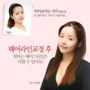 라인헤어 이미지