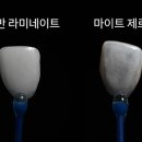 수석치과기공소 이미지