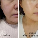 서면리프팅관리 젊어보이는 피부를 만들어주는 곳 &#39;다풀림뷰티랩&#39; 후기