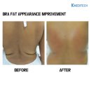 엘리트메디 이미지