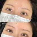 눈부신아침 | [대구/달서구] 월성동 노글루 속눈썹펌 잘하는 곳 눈부신그녀