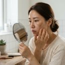 삼산하나약국 | 기미 없애는 법 BEST 4! 화장품으로 안 되던 기미 원인 잡는 법