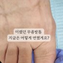 페디베네 이미지