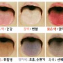 혀의 색은 건강 신호등 이미지