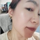 패드야 | 아크넨 패드 후기 여드름 베개 커버 트러블 완화 효과 추천