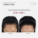 헤어라인 이미지
