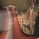 우장산경희한의원 이미지