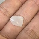 한마음치과기공소 | 무삭제 라미네이트 가격 및 부작용 솔직후기