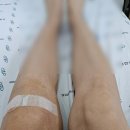 의료법인영경의료재단전주병원 | 원판형 외측 연골판 파열 - 관절경 수술 봉합 및 절제술 후 재활치료 시작 # 1