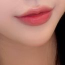 필러 유목민 드디어 정착했어요 💕 아르필의원 필러 후기 이미지