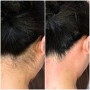 수원-1134 | 경기도 수원 뒷목 왁싱, 결혼 앞두고 찾은 조용한 선택