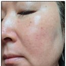 선 | 선에센스 후기｜민감성 피부도 편안했던 아이엠유 유기자차