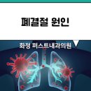 고립성폐결절 원인과 증상 폐암초기증상과 구분 이미지