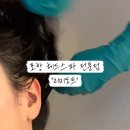 리미도트