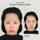 스칼프디자인센터 광주점 이미지