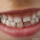 화이트치과의원 | 강남치과 뉴욕화이트치과의원 치료 후기가 궁금하다면