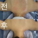 안산피부관리 ‘라썸뷰티’ 거북목, 어깨, 허리통증 에너지테라피