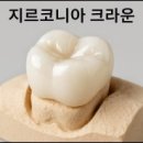 송탄더봄치과의원 네이버블로그