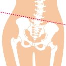 골반교정 필라테스 이미지