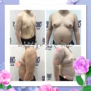 영광비뇨기과의원 | 해운대비뇨기과 여유증수술잘하는곳 선택기준