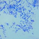 헤이븐동물병원 | 육묘일기_고양이 설사의 발병과 치료(원인/치료과정/병원비/사료)_2화