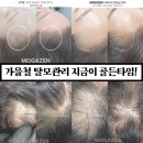 (주)제이비 | 가을철 탈모 골든타임! 대구 더제이비에서 모가젠 생장술로 두피 건강 챙기세요