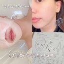 부산케이(K)디젤 | 금정구 장전동 신부관리🍃 케이시즌에스테틱 용카필링관리 후기🫧