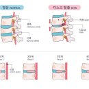 턴핏 이미지