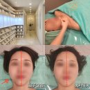 센텀얼굴경락, 고운빛깔센텀점 3D이목구비관리 재방문 후기