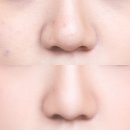 헤어보정# 이미지