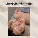 인천 구월동 피부관리샵 더마세이브 악건성 속건조 케어 후기