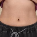 대신한의원 | 부산 서면 다이어트 한의원 추천 지방분해주사 대신 감량비책 선택 후기 (효과, 가격)