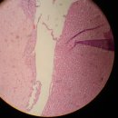 pituitary gland,thyroid gland,adrenal gland 이미지