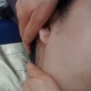 끌리네피부관리아중인후점 네이버블로그