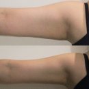 원리 | 온다(ONDA)가 전자렌지와 원리가 같다구요? 원리, 효과, 후기